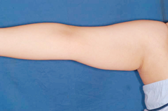 整形前后对比图片