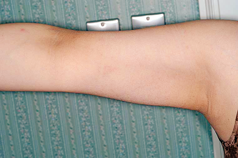 整形前后对比图片