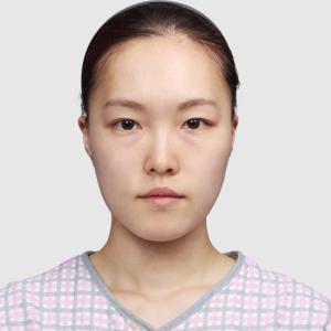 整形前后对比图片