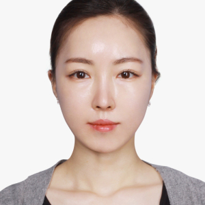 整形前后对比图片