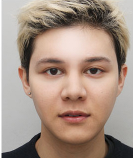 整形前后对比图片