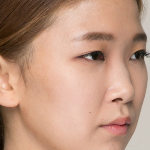 整形前后对比图片