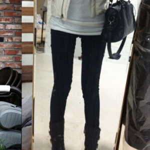 整形前后对比图片