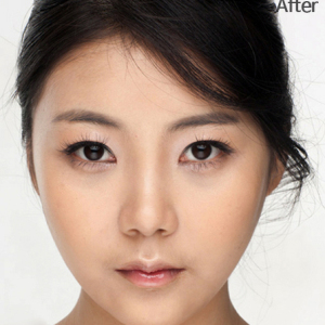 整形前后对比图片