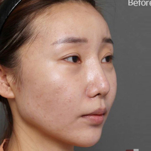 整形前后对比图片