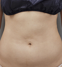 整形前后对比图片