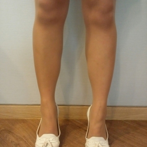 整形前后对比图片