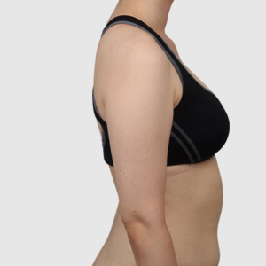 整形前后对比图片