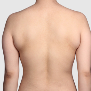 整形前后对比图片