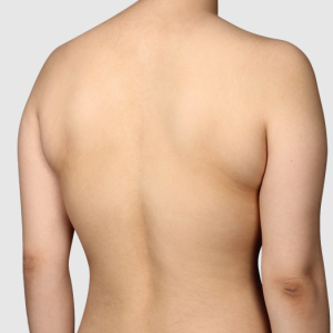 整形前后对比图片