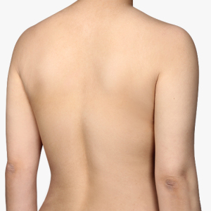 整形前后对比图片