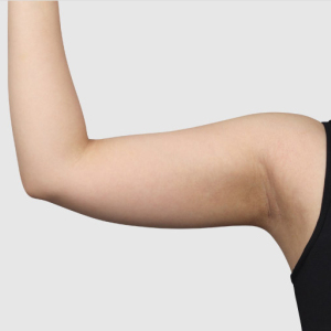 整形前后对比图片