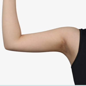 整形前后对比图片