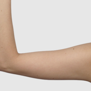 整形前后对比图片