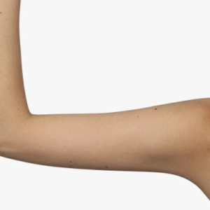 整形前后对比图片