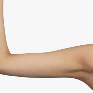 整形前后对比图片