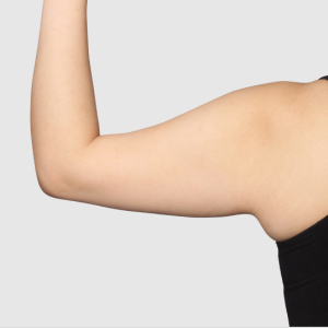 整形前后对比图片