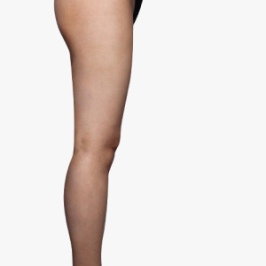 整形前后对比图片