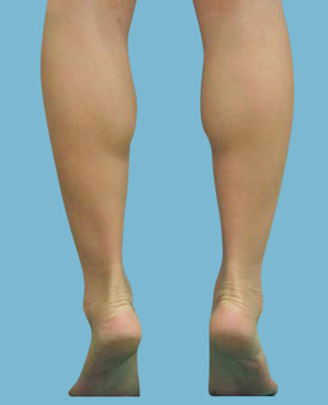 整形前后对比图片