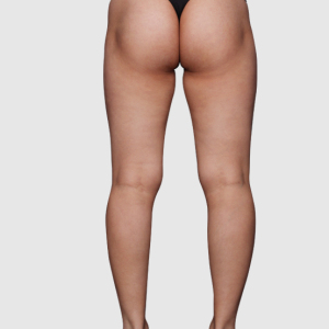 整形前后对比图片