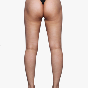 整形前后对比图片