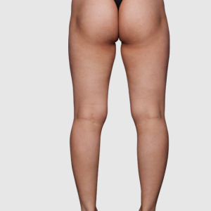 整形前后对比图片