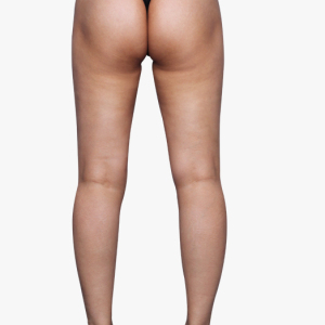 整形前后对比图片