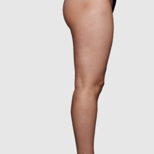 整形前后对比图片