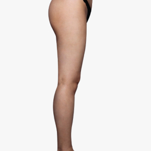 整形前后对比图片