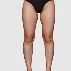 整形前后对比图片