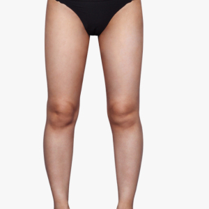 整形前后对比图片