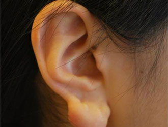 整形前后对比图片