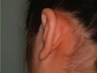 整形前后对比图片