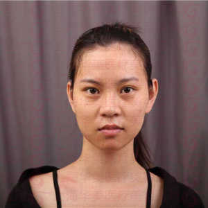 整形前后对比图片