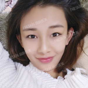 整形前后对比图片