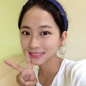 整形前后对比图片