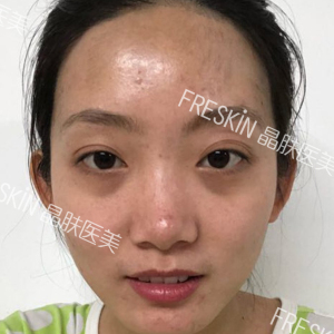 整形前后对比图片