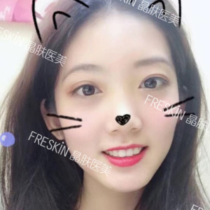 整形前后对比图片