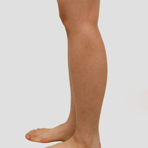 整形前后对比图片