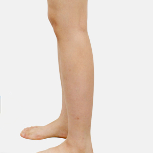 整形前后对比图片