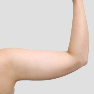 整形前后对比图片