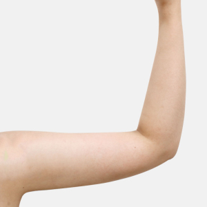 整形前后对比图片