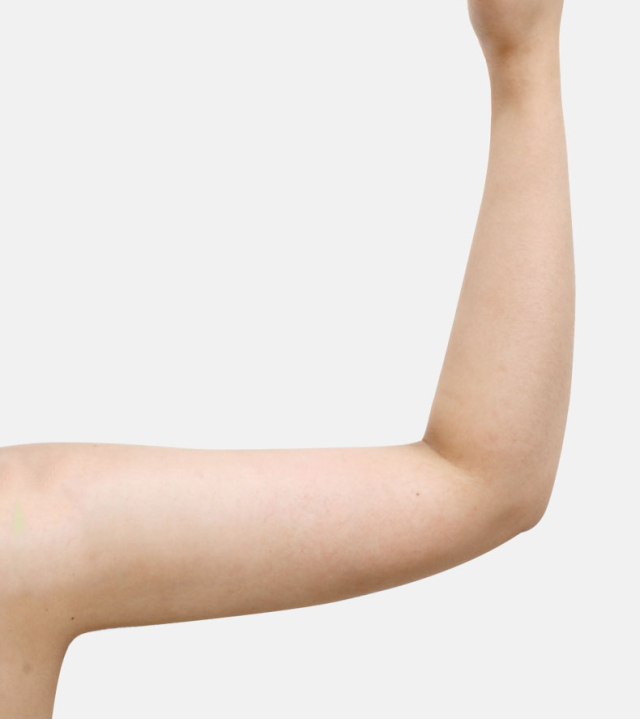 酥吟的整形术后图片