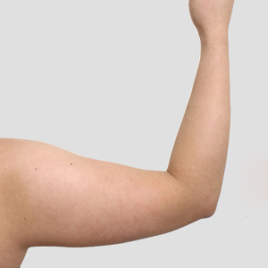 整形前后对比图片