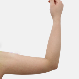 整形前后对比图片