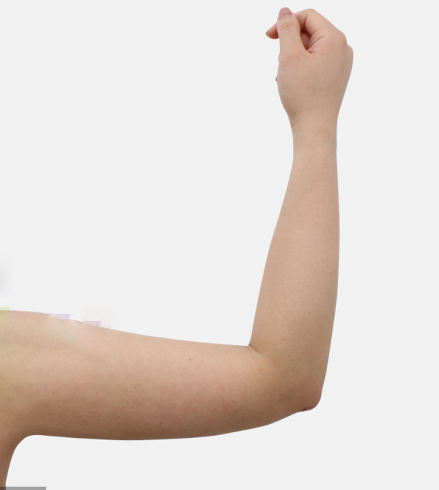 苏星蓉的整形术后图片