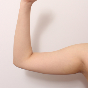 整形前后对比图片