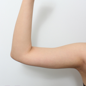 整形前后对比图片