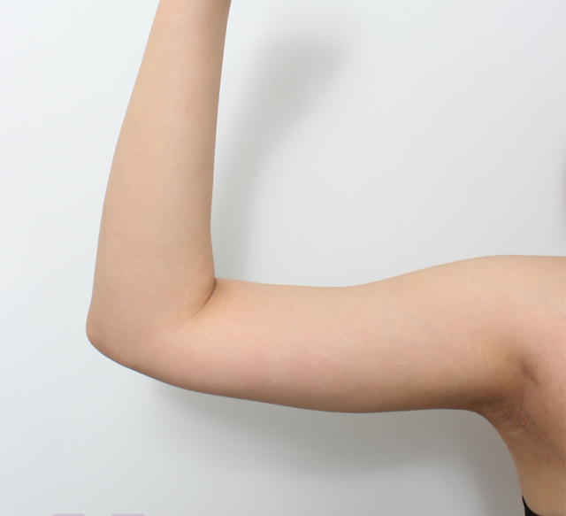 长书枕的整形术后图片