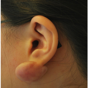 整形前后对比图片